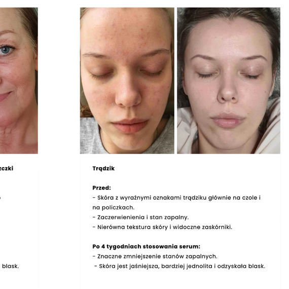 Zestaw MAXI - kosmetyki ze śluzem ślimaka do skóry tłustej i mieszanej - Nature Cosmetics - OILY SKIN